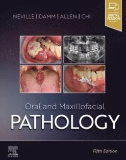 Oral and Maxillofacial Pathology